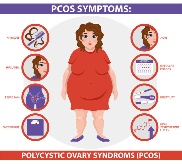 Polycystic Ovary Syndrome PCOS The Golden Lady Polycystic Ovary Syndrome PCOS The Golden Lady